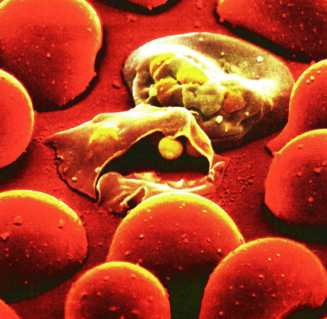 жизненный цикл малярийного плазмодия
