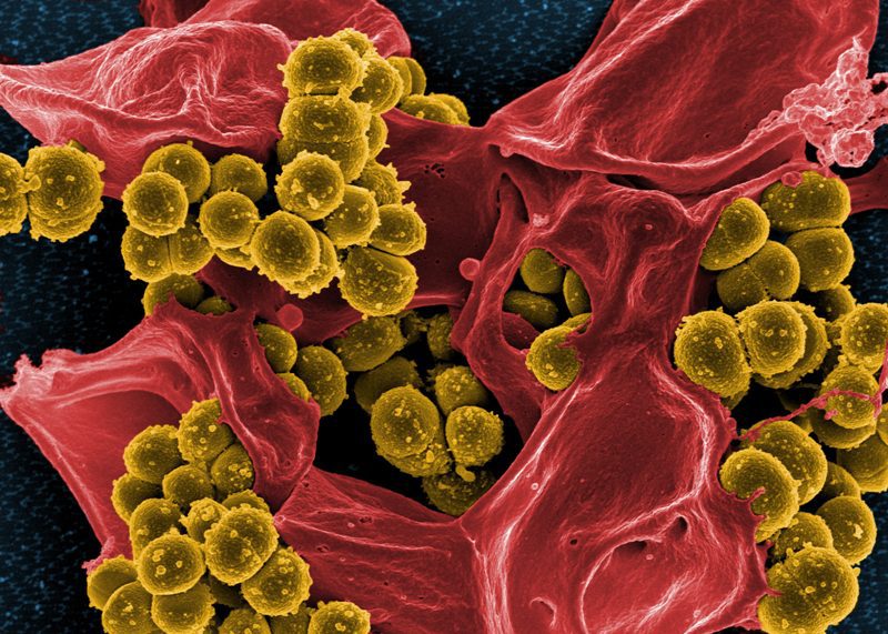 Золотистый микроб